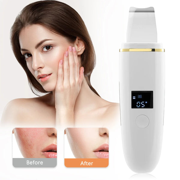 Ultrasonic Skin Scrubber Vibration Face