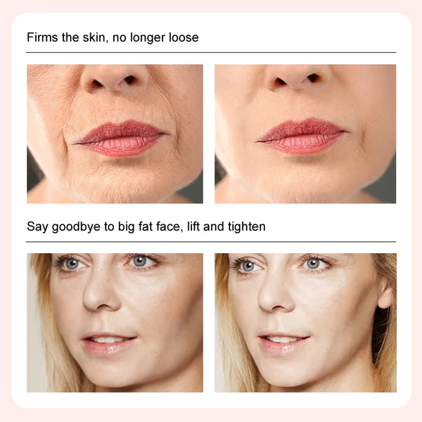 Face-lift Cream Slimming Face